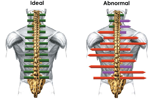 emg of spine